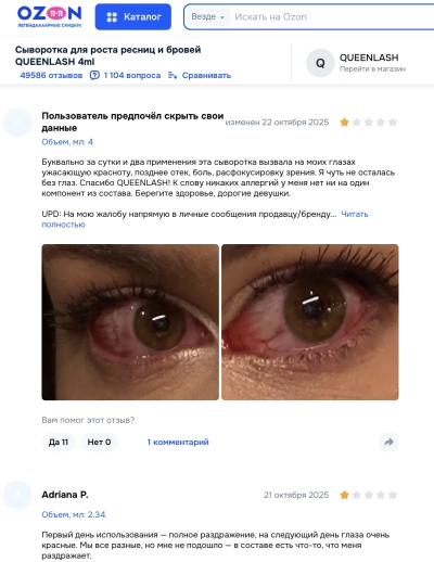 Queenlash отзывы: что стоит за обещаниями длинных ресниц